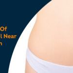 oil on belly button - Pristyn Care