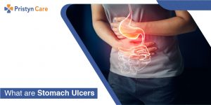 Stomach Ulcers - Pristyn Care