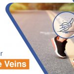 foods for varicose veins - Pristyn Care