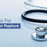 Ovarian Cyst | Pristyn Care