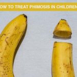 Cover image for phimosis in children