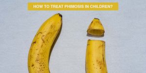 Cover image for phimosis in children