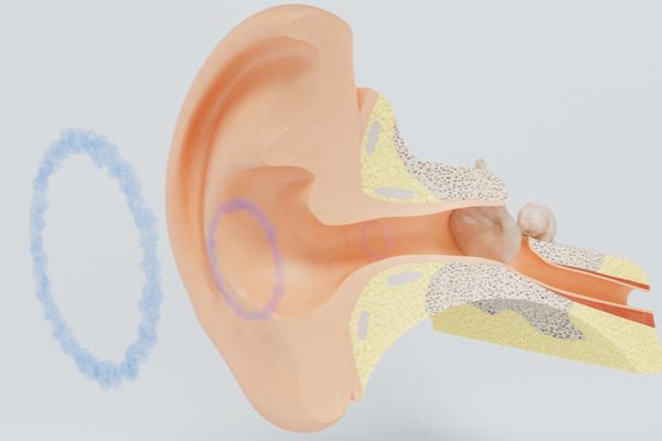 Creating a vacuum inside the ear