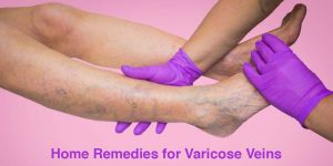 Gloved hands Checking veins in legs