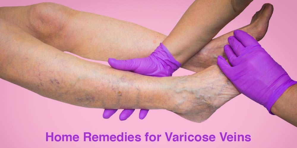 reduce varicose veins and swelling of legs - Buy reduce varicose