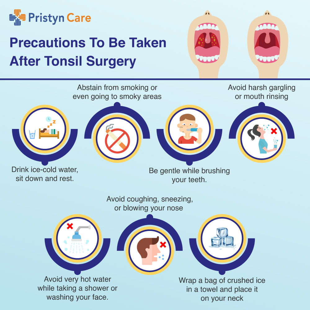 Precautions-To-Be-Taken-After-Tonsil-Surgery