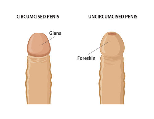 With dick sex uncircumcised 37 Women