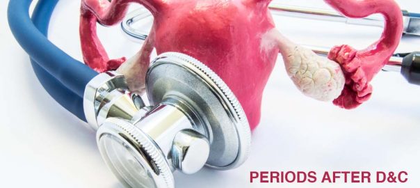 How and When does a woman have periods after D&C procedure? - Pristyn Care How and When does a woman have periods after D&C procedure? - Pristyn Care