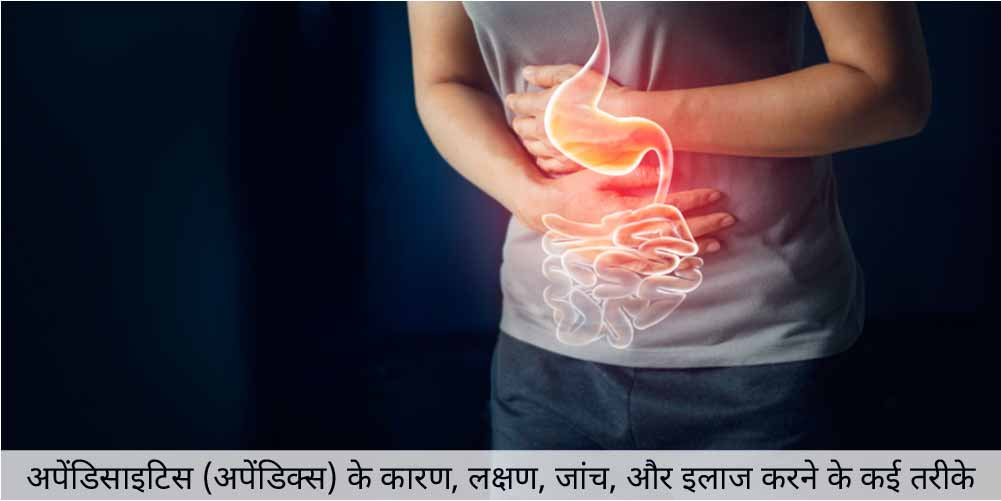 अपेंडिसाइटिस