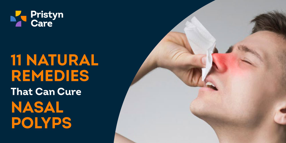 11 Natural Remedies That Can Cure Nasal Polyps