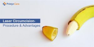 Laser Circumcision- Procedure and Advantages