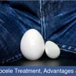 Laser Hydrocele Treatment, Advantages & Recovery