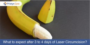 What to expect after 3 to 4 days of laser circumcision?