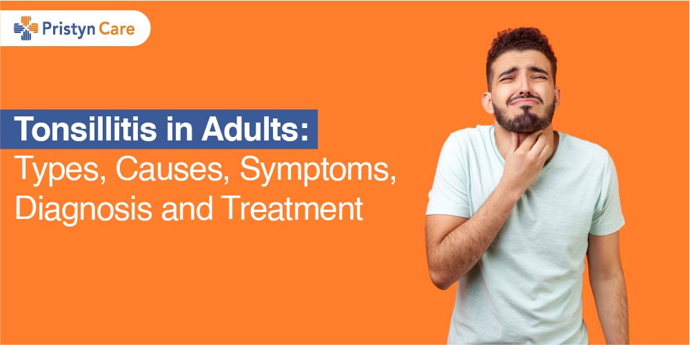 Tonsillitis In Adults Types Causes Symptoms Diagnosis And