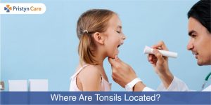 Cover image for where are the tonsils located