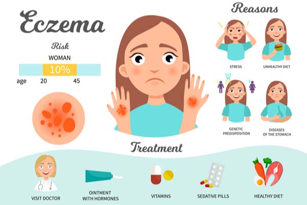 Eczema- Cause of Itchiness in legs