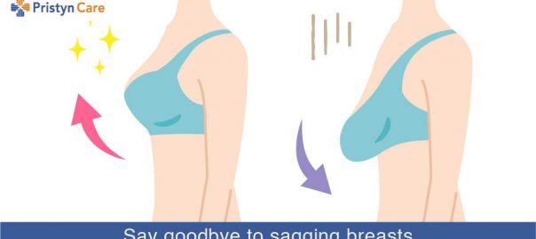 sagging breast bra fitting