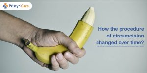 how the procedure of circumcision changed