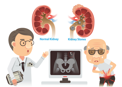 doctor explaining causes of kidney pain