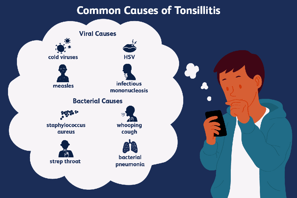 what-causes-swollen-tonsils