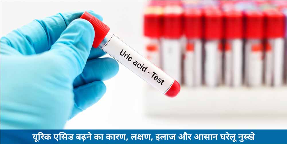 यूरिक एसिड बढ़ने का कारण, लक्षण, इलाज और आसान घरेलू नुस्खे