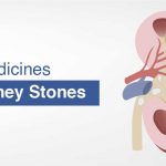 Best Medicines for kidney stones
