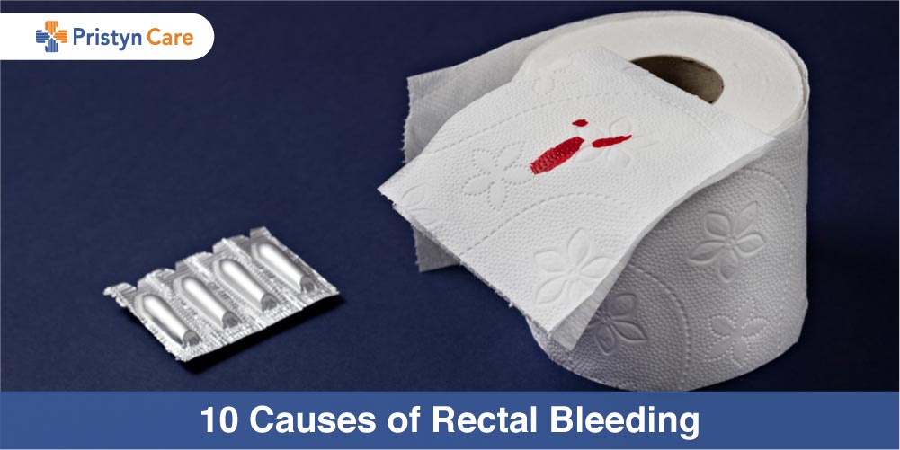 Reasons for anal bleeding