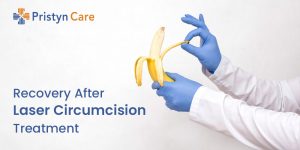 Circumcision