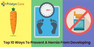 Cover image for 10 ways to prevent hernia from developing