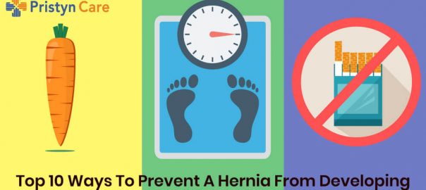 Top 10 Ways To Prevent A Hernia From Developing