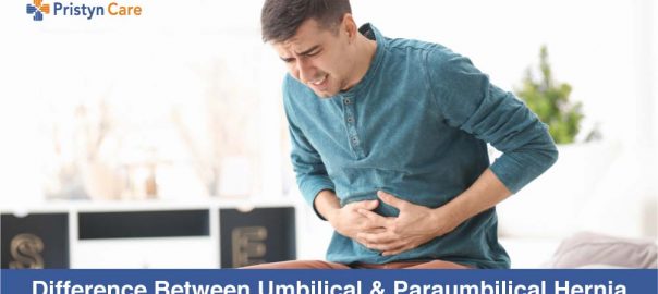 Difference Between Umbilical and Paraumbilical Hernia