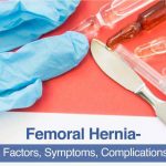 Cover image for femoral hernia
