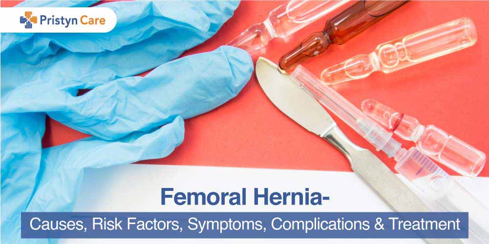 Femoral hernia Information