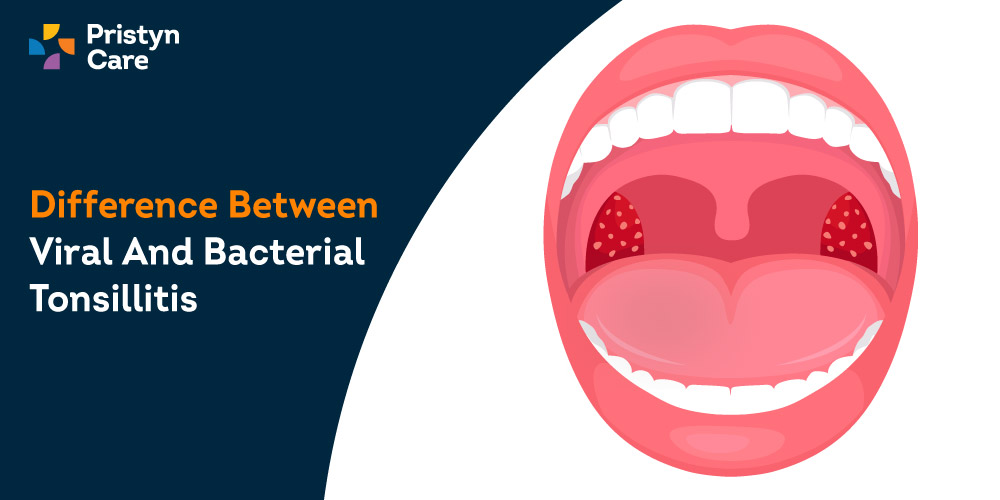 Cover image for bacterial and viral tonsillitis