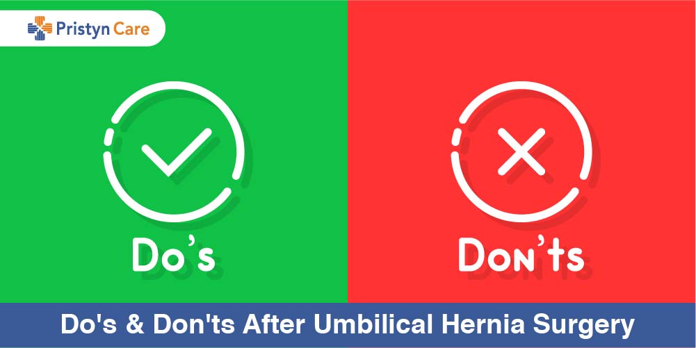 Dos and donts of umbilical hernia surgery