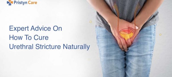 Expert Advice On How To Cure Urethral Stricture Naturally?
