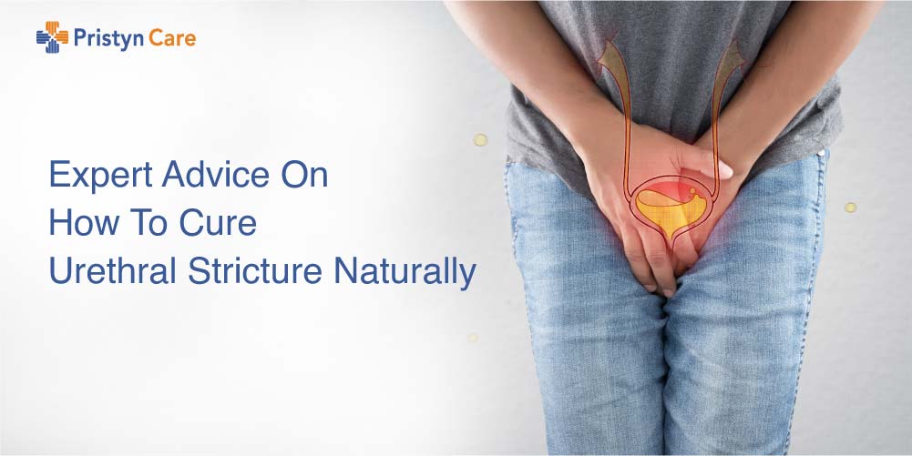 Expert advice on natural treatment for urethral stricture