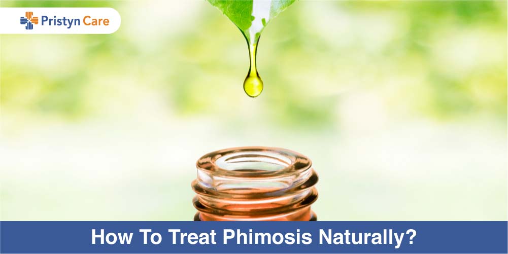 How To treat phimosis naturally