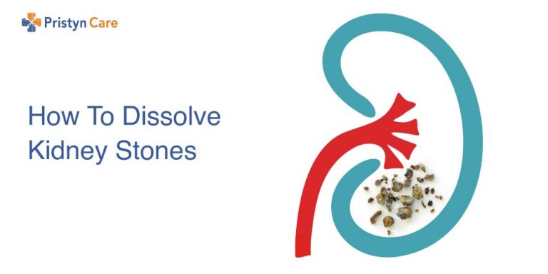 How to dissolve kidney stones
