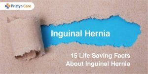 Inguinal Hernia Facts
