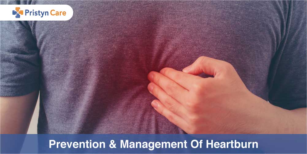 Management and prevention of heartburn