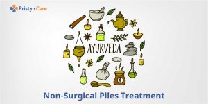 Non-Surgical Piles Treatment