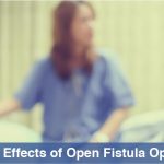 Side effects of fistula surgery