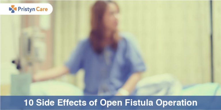 Side effects of fistula surgery