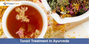 Tonsil treatment in Ayurveda