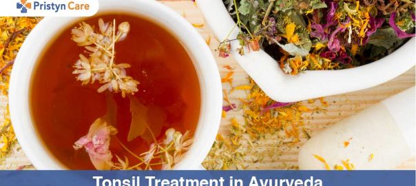 Tonsillitis Treatment in Ayurveda