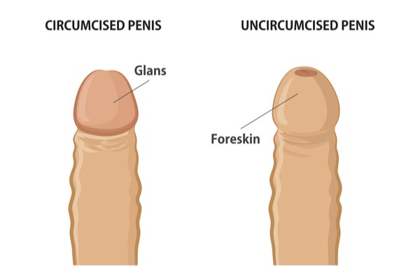 circumcised penis