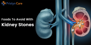 foods to avoid in kidney stone