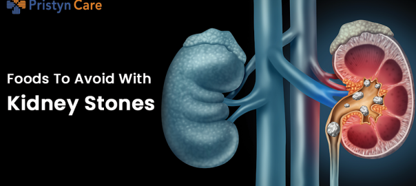 Foods To Avoid With Kidney Stones