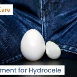 Hydrocele
